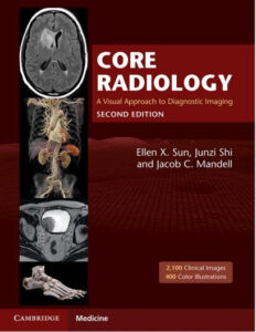 Core Radiology: A Visual Approach to Diagnostic Imaging 2nd Edition eBook cover