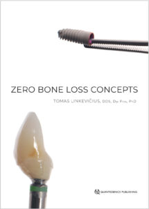 Zero Bone Loss Concepts 1st Edition by Tomas Linkevicius 9780867157994 eBook cover