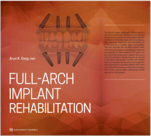 Full-Arch Implant Rehabilitation 1st Edition by Arun K. Garg 9780867158090 eBook cover