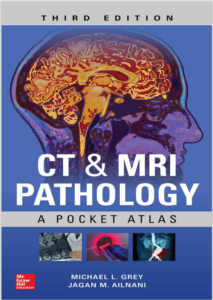 CT & MRI Pathology: A Pocket Atlas, Third Edition 3rd Edition By Michael Grey eBook cover