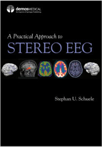 A Practical Approach to Stereo EEG 1st Edition by Stephan U. Schuele eBook cover